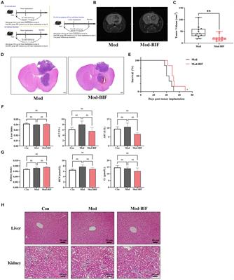 Multi-omics-based investigation of Bifidobacterium’s inhibitory effect on glioma: regulation of tumor and gut microbiota, and MEK/ERK cascade